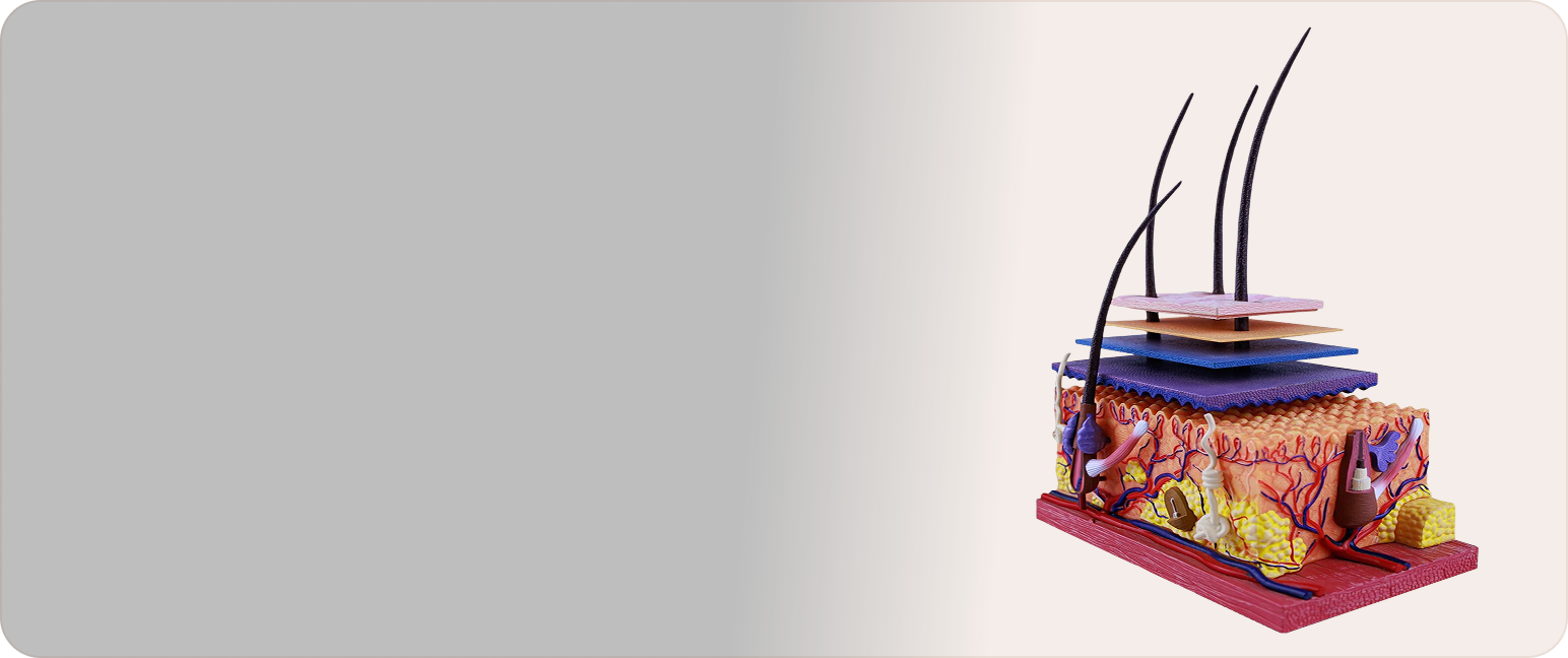 Understanding Alopecia Areata