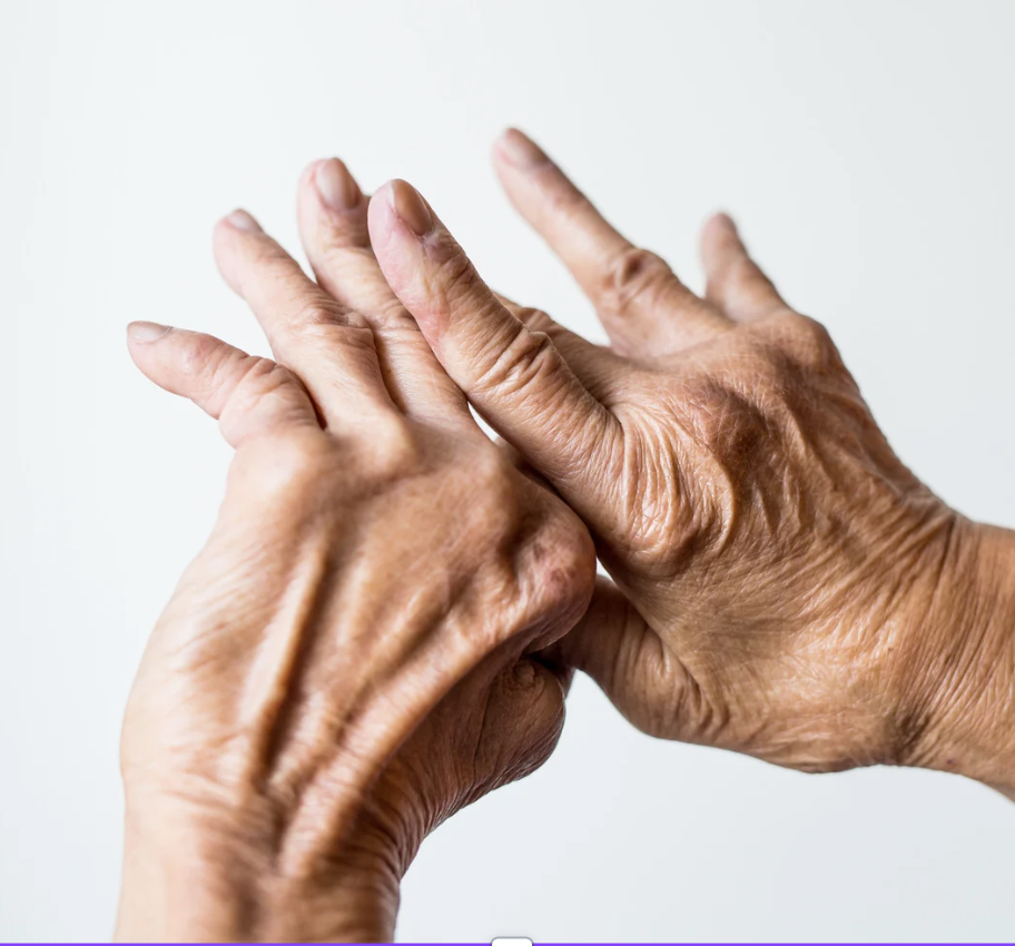 Rheumatoid arthritis