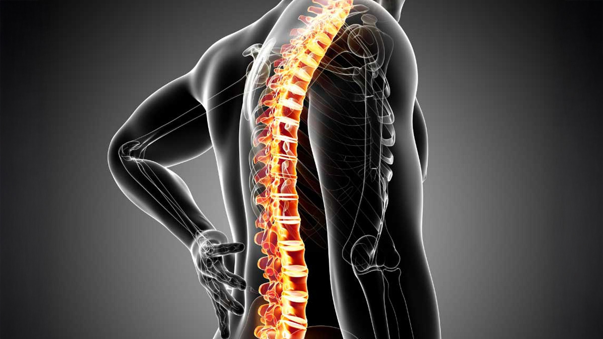 Non-Radiographic Axial Spondyloarthritis
