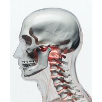 Cervical Osteoarthritis