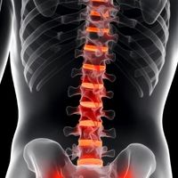 Non-Radiographic axSpA