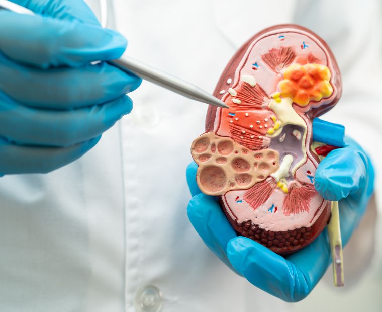 Our Experience in Nephrotic Syndrome