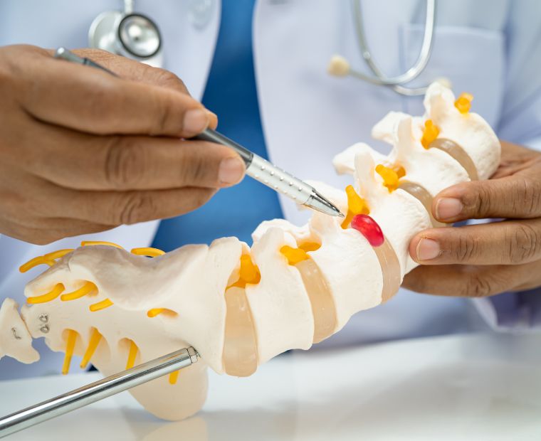 Our Experience in Psoriatic Arthritis