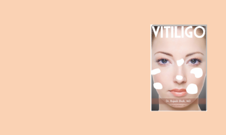 vitiligo book