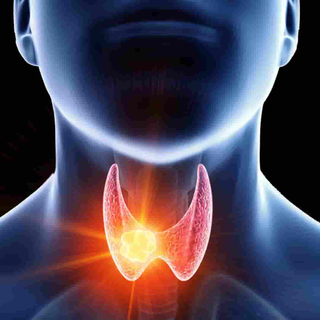 Underactive Thyroid