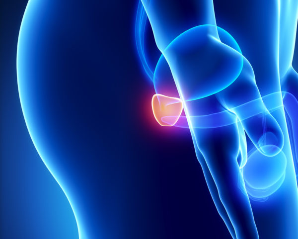 Chronic non-bacterila